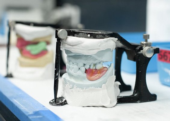 Dentures being crafted