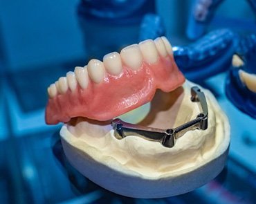 Denture at dental lab
